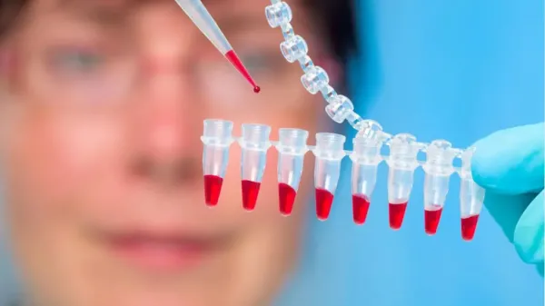 Hematolojiyle hangi bilim dalları  ilgilenir?